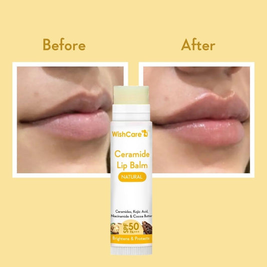WishCare Ceramide Lip Balm with SPF50 PA+++ - Kojic Acid & Niacinamide, 5 gm