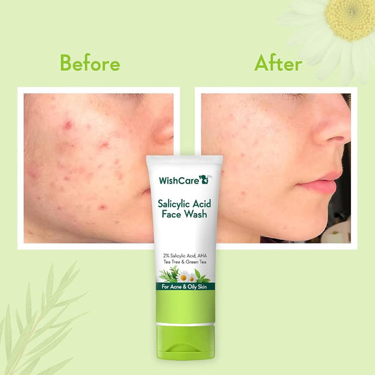 WishCare 2% Salicylic Acid Face Wash with AHA, GreenTea, Chamomile & TeaTree, 100 gm