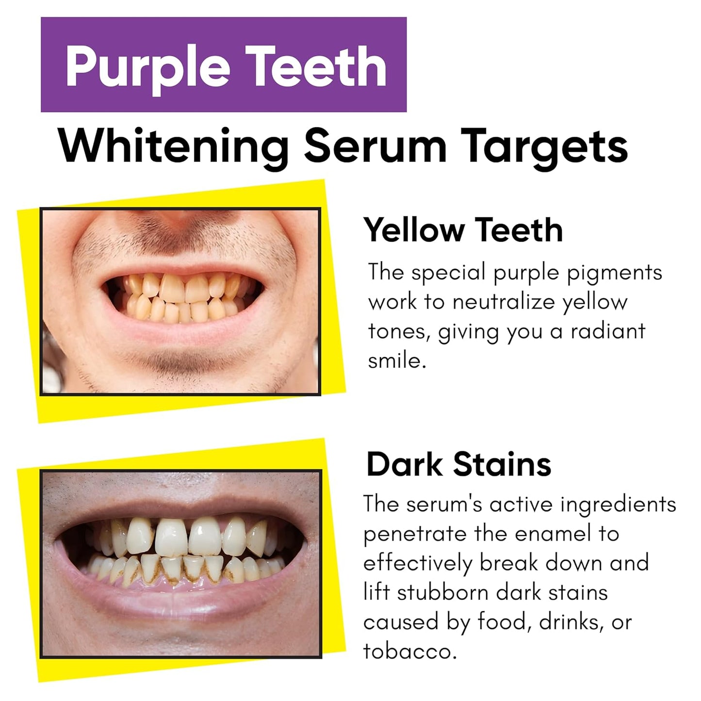 Masofta Purple Teeth Whitening Serum For Yellow & Dark Teeth Stains, 50 ml