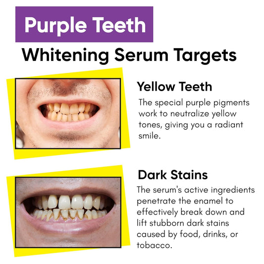 Masofta Purple Teeth Whitening Serum For Yellow & Dark Teeth Stains, 50 ml