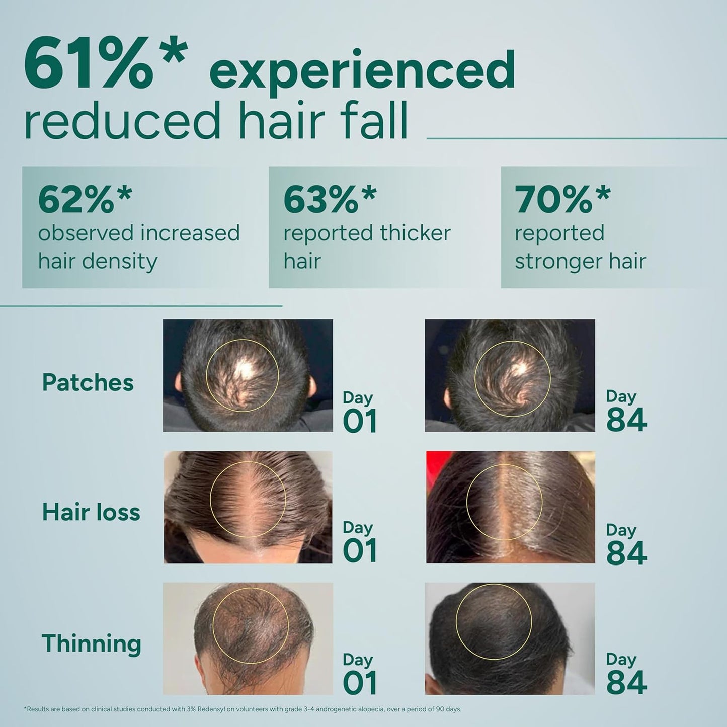 Arata Hair Growth Serum (30ml) with 3% Redensyl, 3% Procapil, 5% Kopexil, Caffeine & Rice Water | No Minoxidil | Supports Hair Growth | Helps Reduce Hairfall | Serum For Women and Men