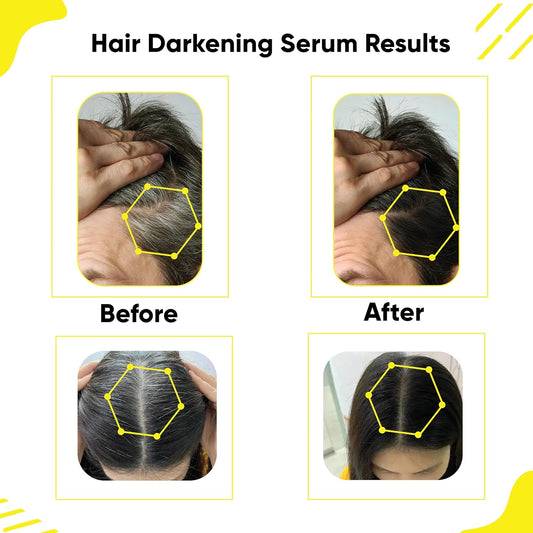 Masofta Hair Darkening Serum | Limits Hair & Beard Greying, 30 ml