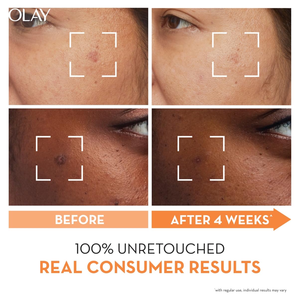 Olay Vitamin C Face Cream with Niacinamide, Normal, Oily, Dry & Combination Skin, 50 gm