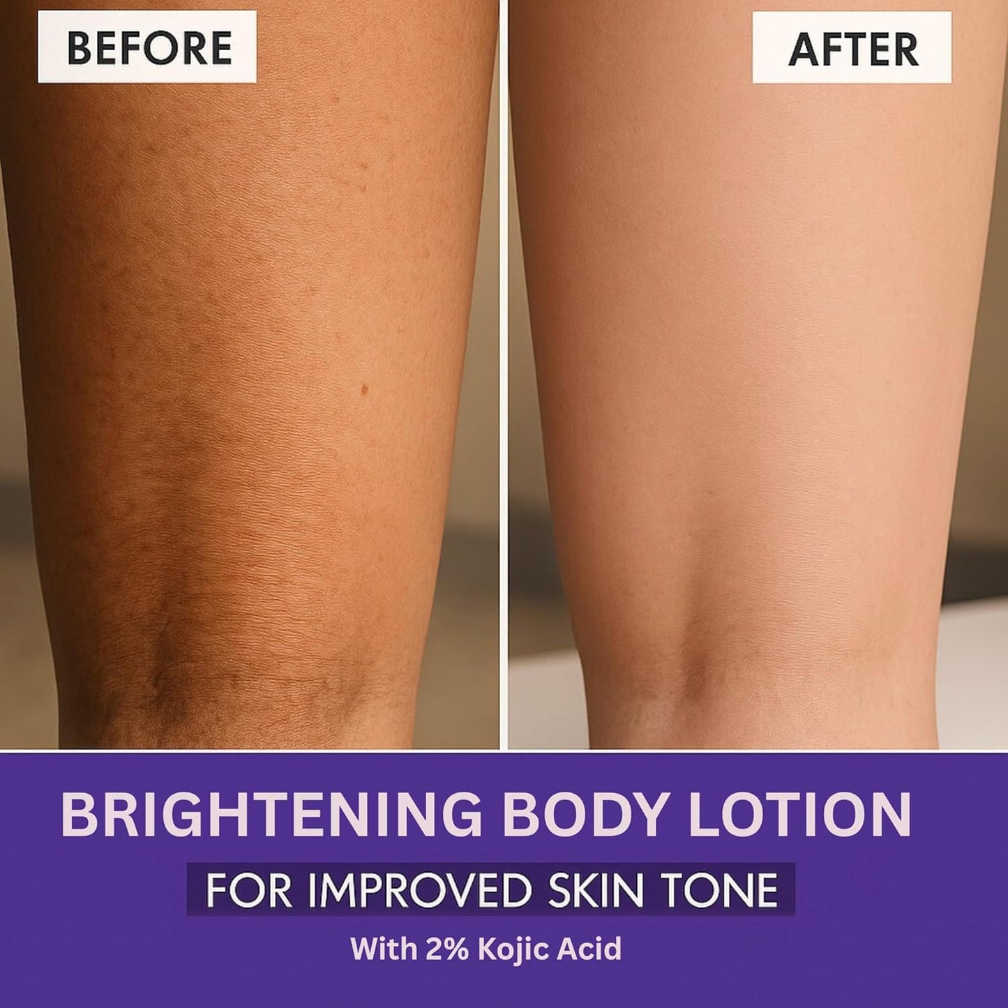 BAKE 2% Kojic Acid Brightening Body Lotion with Niacinamide & SPF 30 PA+++ for Pigmentation & Tan Removal | For Dark Spots & Sun Protection | De-Tan Body Lotion | Tanned & Pigmented Skin | For Women & Men | 200ml