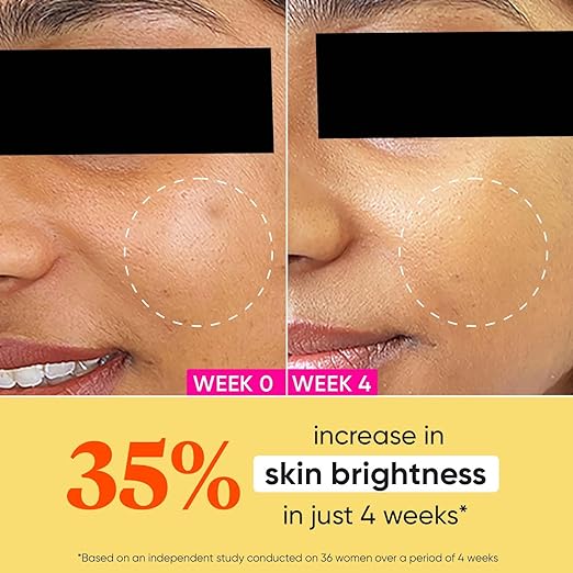 Dot & Key Vitamin C + E Sorbet Super Bright Moisturizer for Face , 60 ml