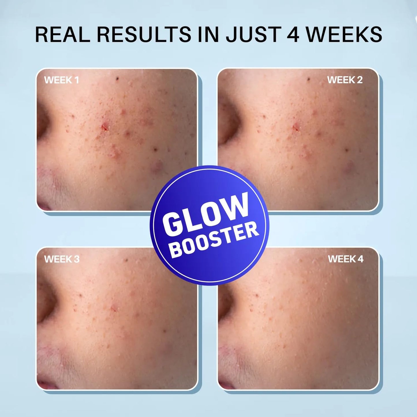 DERMDOC 2% Kojic Acid Glow Fusion Formula Night Cream with Niacinamide & Alpha Arbutin for Skin Brightening | Face Cream I Night Cream I I Glowing Skin 15g