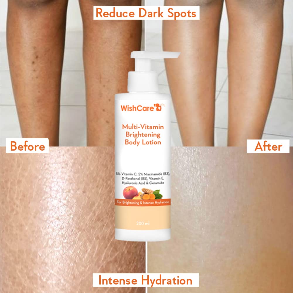 WishCare Multi-Vitamin Brightening Body Lotion - 5% Vitamin C, 5% Niacinamide(B3), Panthenol(B5), 200 ml