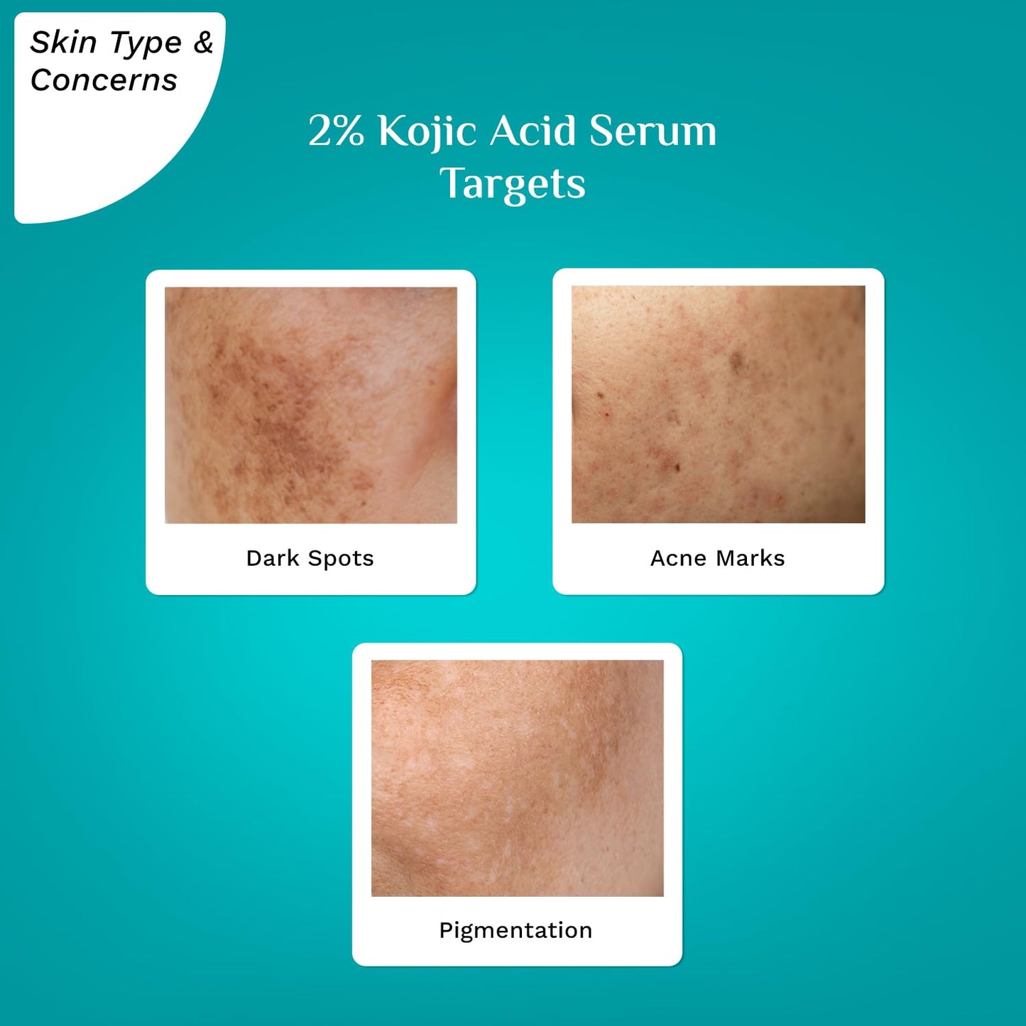 Pilgrim 2% Kojic Acid Serum for face, 30 ml