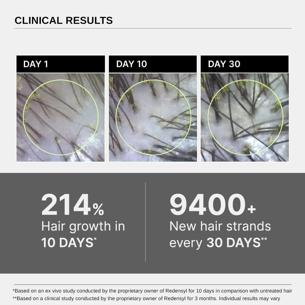 Bare Anatomy Advanced Hair Growth Serum | 3% Redensyl + 4% Anagain + 3% Baicapil + 1% Capilia Longa, Rosemary, Biotin & Rice Extract | Hair growth & Hair fall control serum for Women & Men | 30mL (Pack of 3)