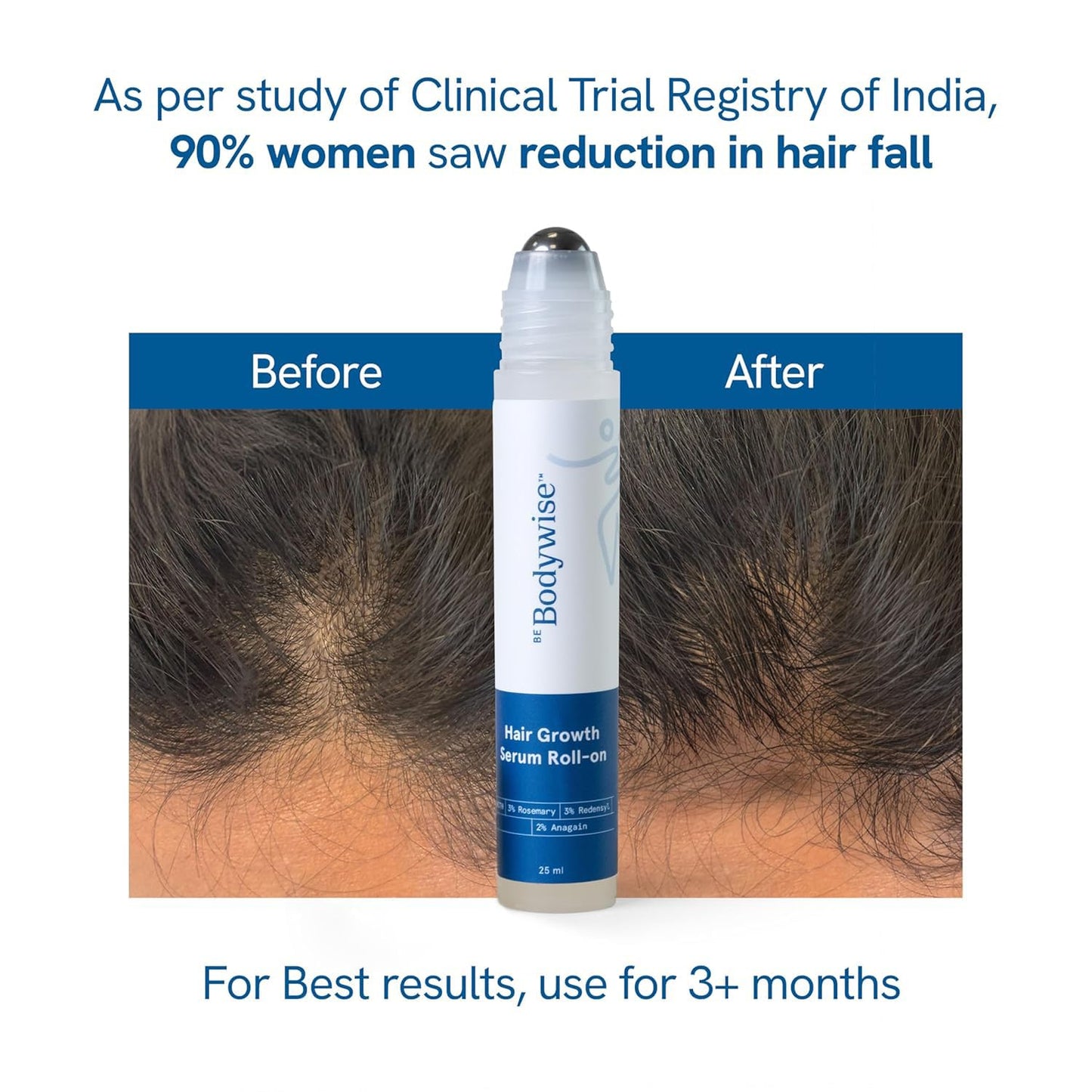 Be Bodywise 3% Redensyl & Rosemary Hair Growth Serum (Roll On), 25 ml, Pack of 2