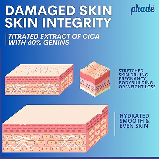 Phade Stretch Mark Cream with CICA for Pregnancy, Scars, Uneven Skin Tone, Ageing - 200 ml