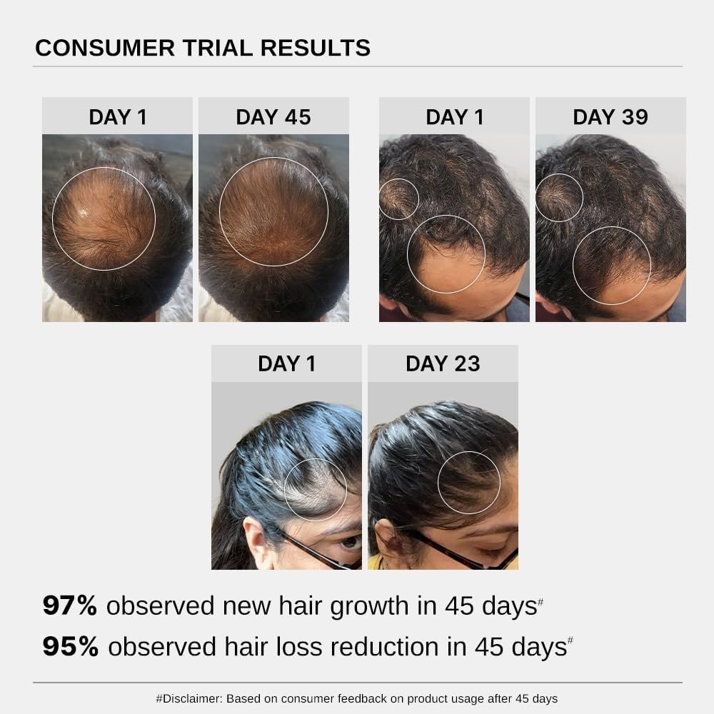 Bare Anatomy Advanced Hair Growth Serum | 3% Redensyl + 4% Anagain + 3% Baicapil + 1% Capilia Longa, Rosemary, Biotin & Rice Extract | Hair growth & Hair fall control serum for Women & Men | 30mL (Pack of 3)