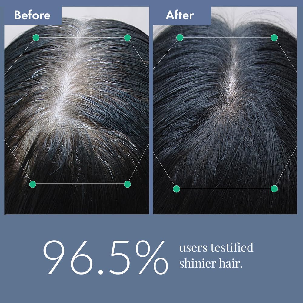 ThriveCo Anti-Grey Hair Prime Serum | Reverses & Limits Hair Greying | Arcolys + Biotin + Black Tea Extract | Light-Weight, Non-Sticky & Odourless | For Men and Women | 50 Ml