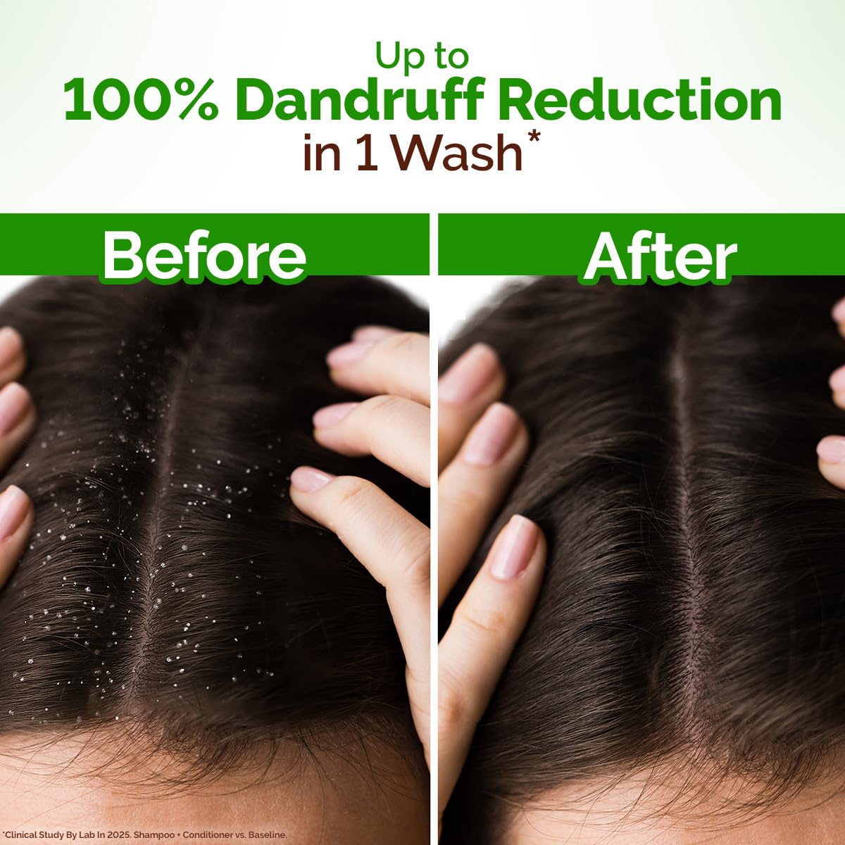Mamaearth Lemon Anti-Dandruff Shampoo with Lemon, ZPTO, Climbazole, Aloe Vera for Itchy & Flaky Scalp | Upto 100% Dandruff Reduction & 3X Softer Hair in 1 Wash | Soothes Scalp | Reduces Frizz | 250 ml