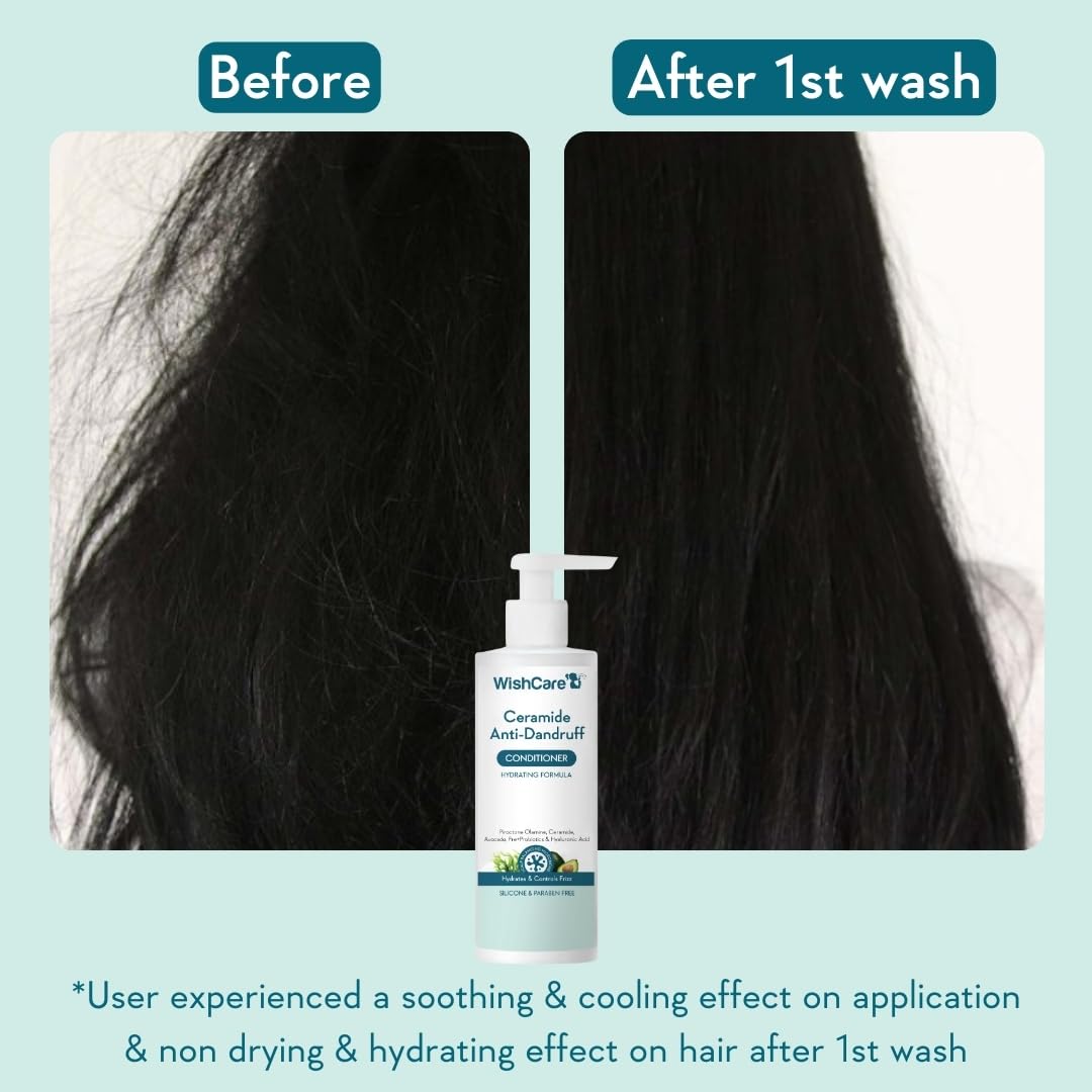 WishCare Ceramide Anti Dandruff Conditioner, Pre+Probiotics & Hyaluronic Acid, 200ml