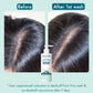 WishCare Hydrating AHA BHA Anti Dandruff Shampoo, 250 ml