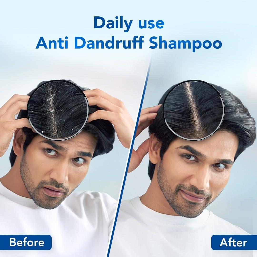 Scalpe Pro Daily Anti-Dandruff Shampoo , 200 ml