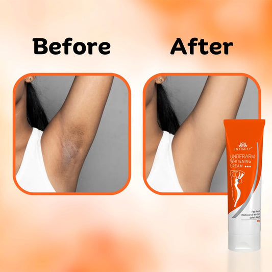 INTIMIFY Underarm Whitening Cream for Women, Armpit Whitening Cream Natural with Kojic Acid & Vitamin B3 20g