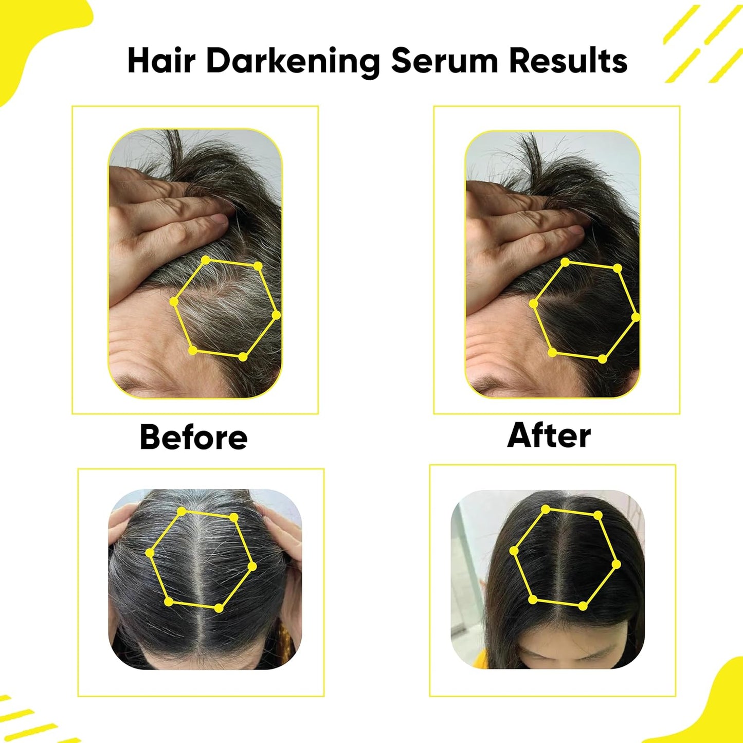 Masofta Hair Darkening Serum | Limits Hair & Beard Greying, 30 ml
