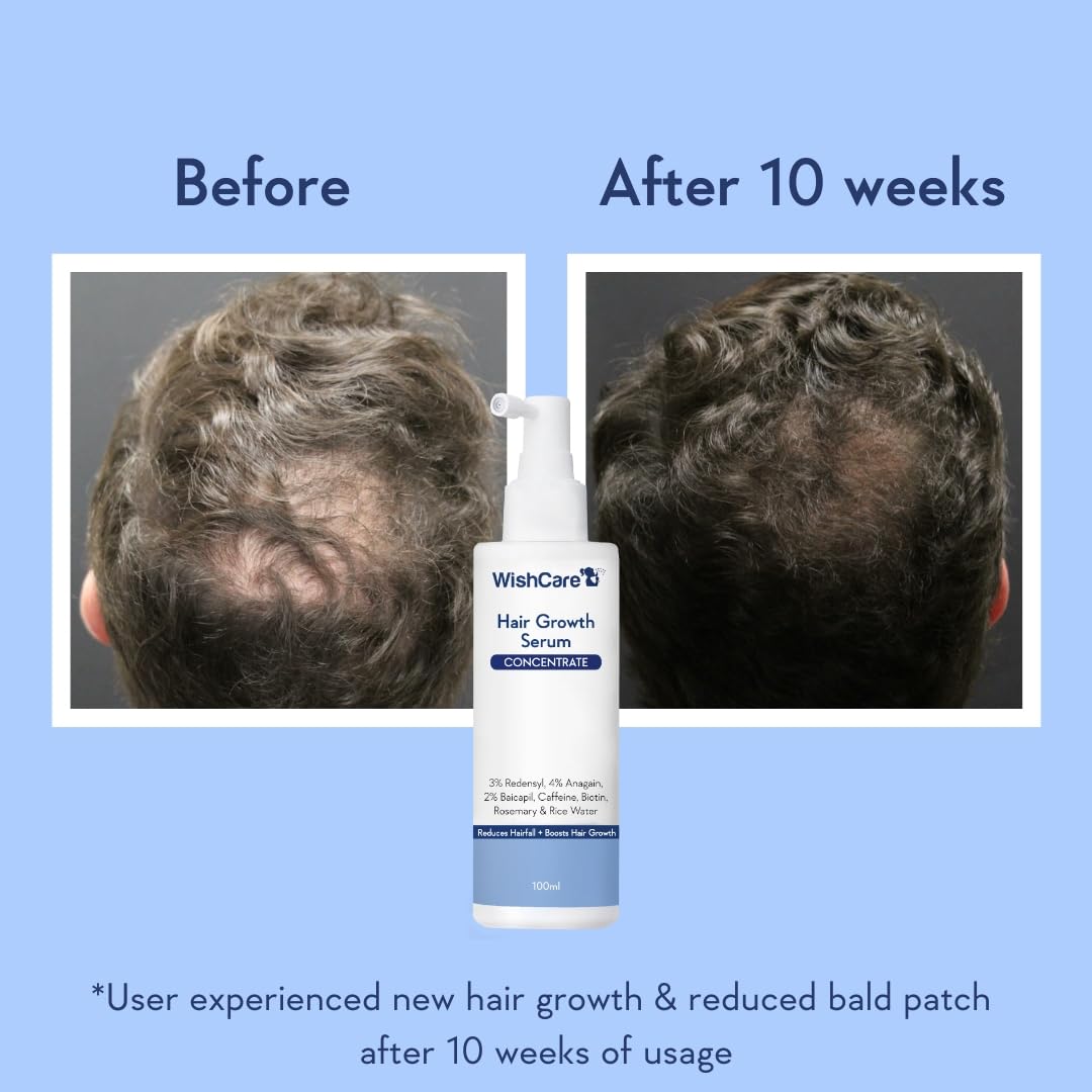 WishCare Hair Growth Serum Concentrate - 3% Redensyl, 4% Anagain, 2% Baicapil, Caffeine, Biotin & Rice Water, 100 ml