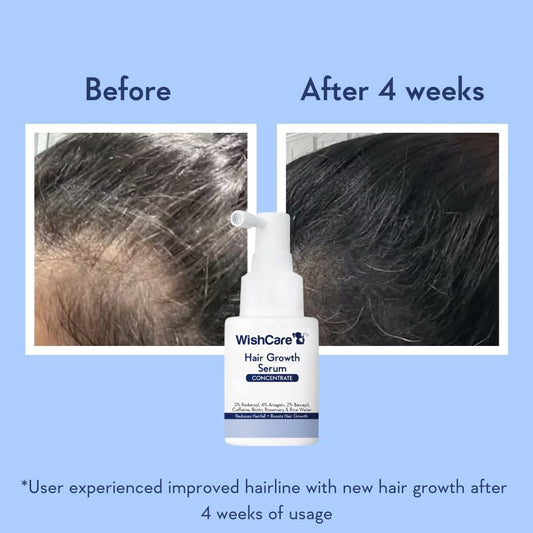 WishCare Hair Growth Serum Concentrate - Resdensyl, Anagain, Caffeine, Biotin, Keratin & Rice Water 20 ml