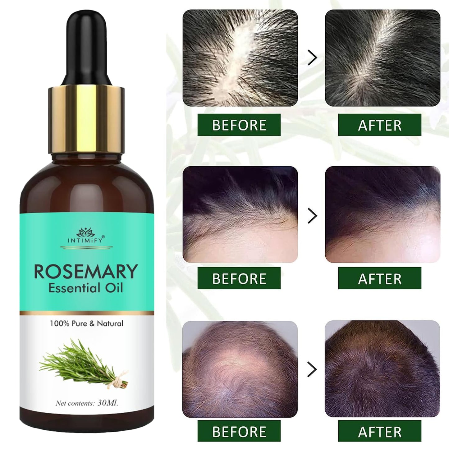 INTIMIFY Rosemary Essential Oil For Hair Growth, 30 ml