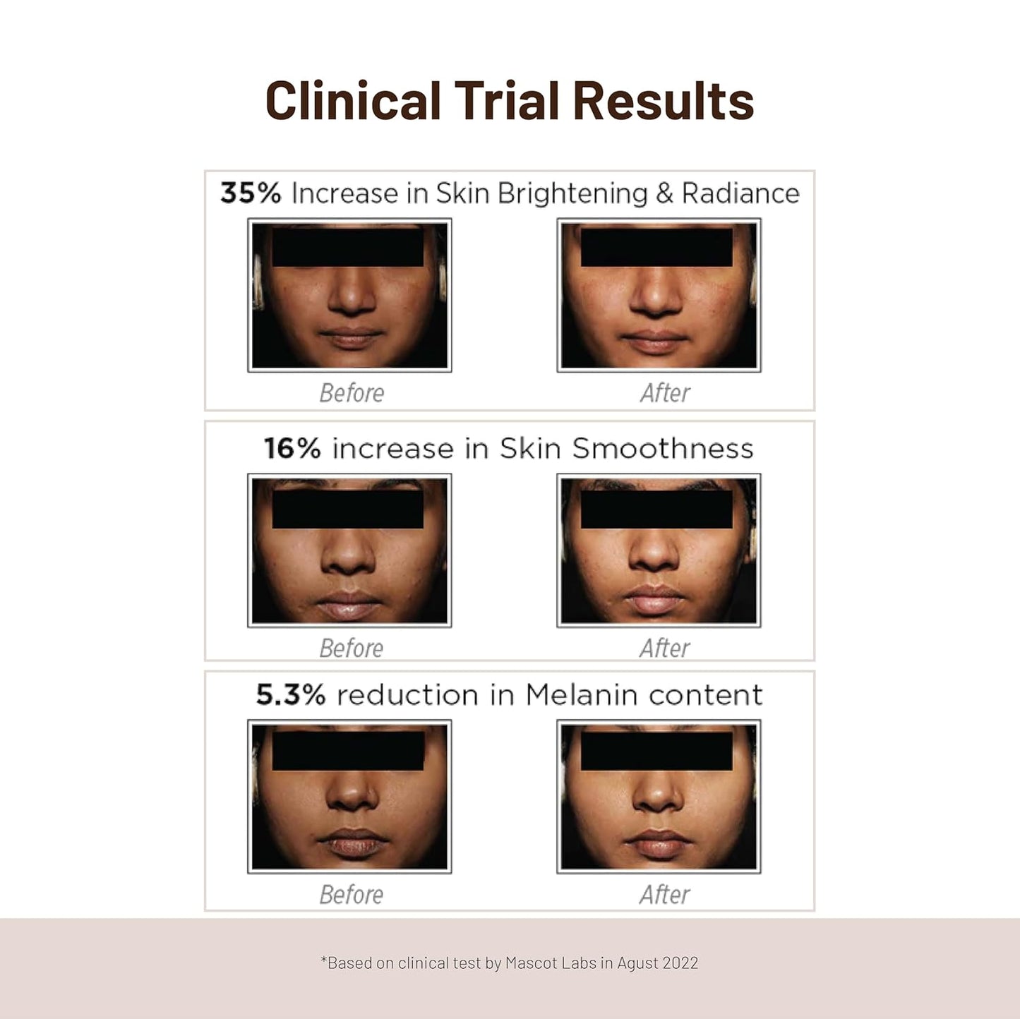 SkinQ Brightening Serum, Licorice & Lactic Acid, Face Elixir for Tan, Pigmentation & Dark Spots, 30 ml