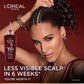L'Oréal Paris Fall Resist Anti Hair Fall Serum with 1.5% Aminexil, Caffeine & Arginine for lesser visible scalp & hair fall, 102ml