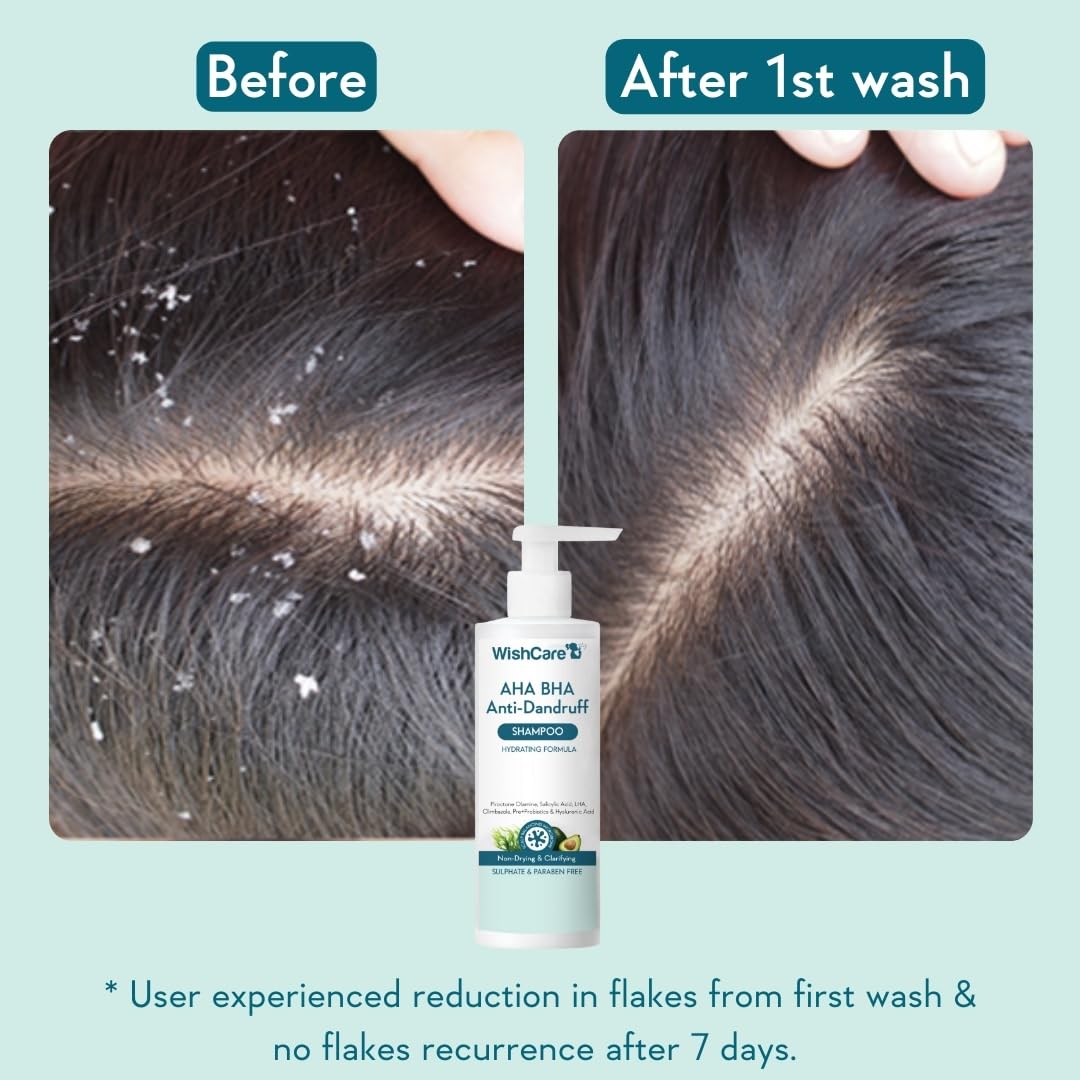 WishCare Hydrating AHA BHA Anti Dandruff Shampoo, 250 ml