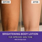BAKE 2% Kojic Acid Brightening Body Lotion with Niacinamide & SPF 30 PA+++ for Pigmentation & Tan Removal | For Dark Spots & Sun Protection | De-Tan Body Lotion | Tanned & Pigmented Skin | For Women & Men | 200ml