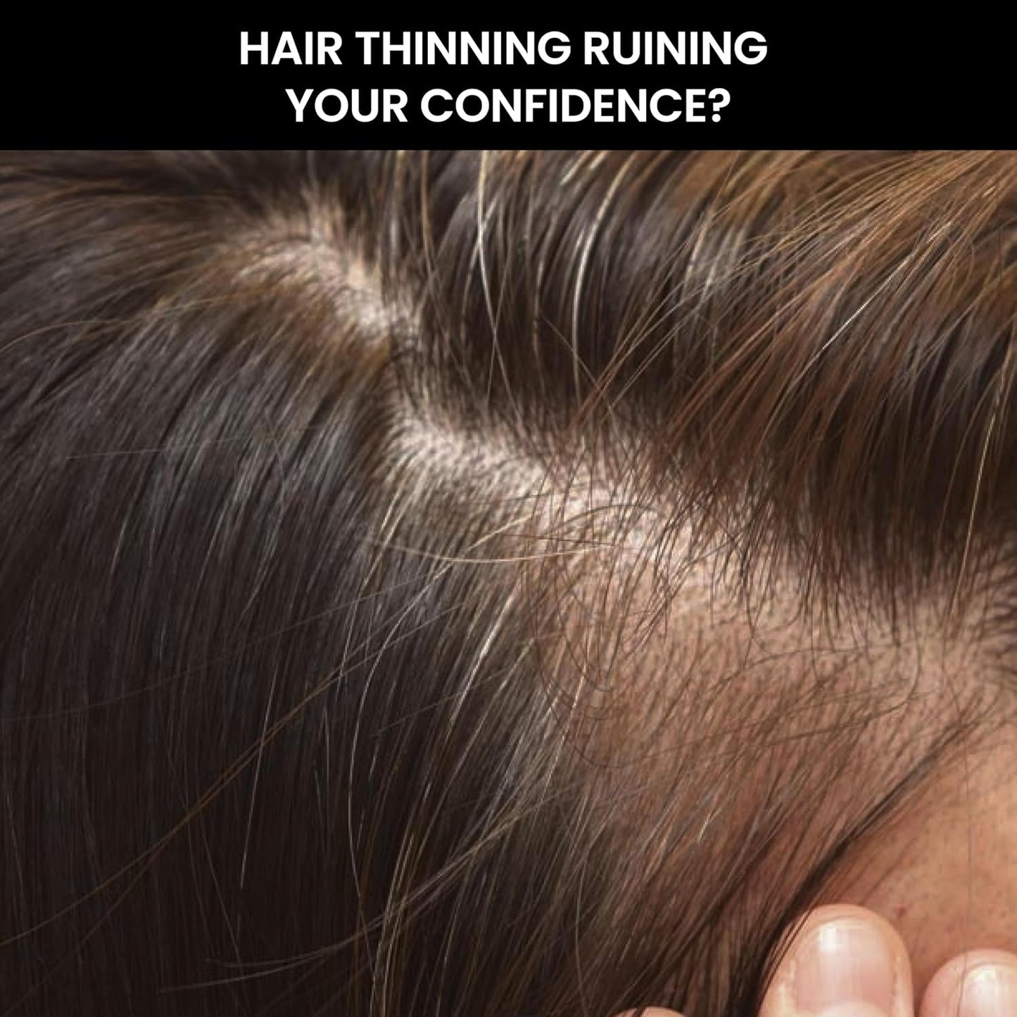 ThriveCo Hair Thickener Volumizing Serum | For Fine, Thinning Hair | Gives Instant Hair Volume & Density | With Pea Peptide & Rosemary | For Men & Women | Vegan, Cruelty-free & Dermat-Tested | 100ml