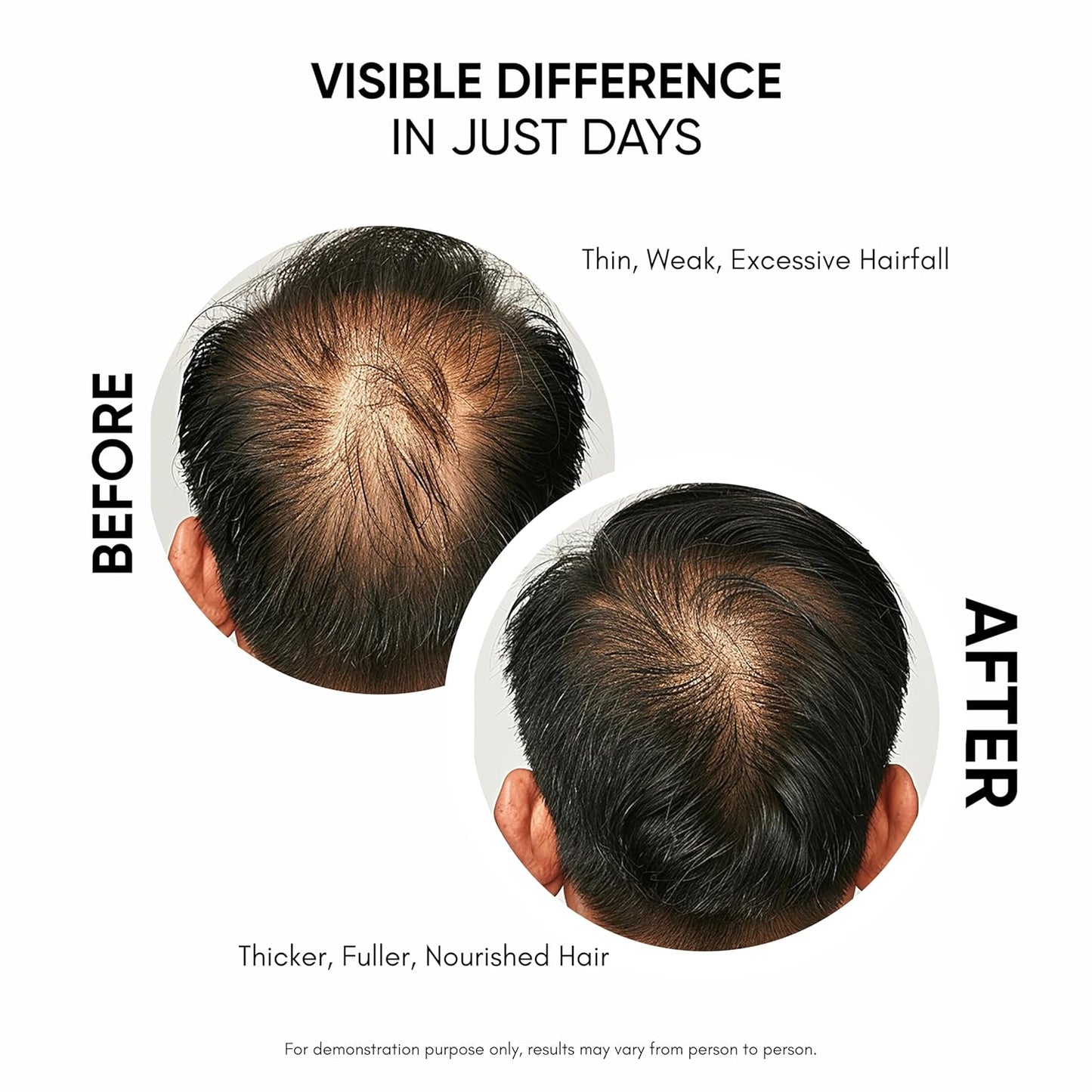 Masofta Hair Growth Serum, 50 ml