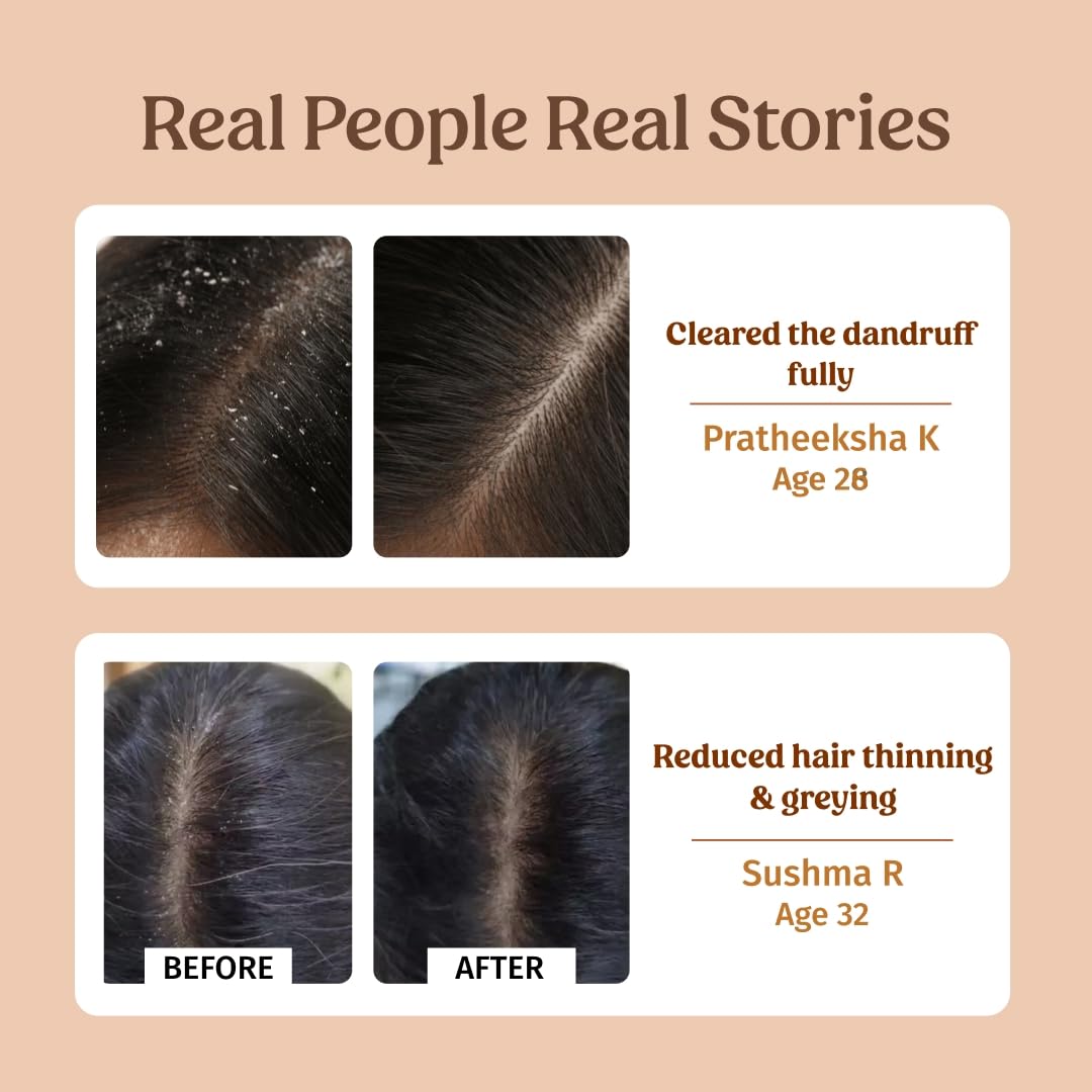 Vilvah Store Herbal Shampoo for Dandruff Control, Anti Dandruff Shampoo, Relieves from dandruff related itching, Soothes Scalp & Nourishes Hair, SLS & Paraben Free, For Men and Women, 250ml