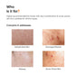 Minimalist Dehydrated Skin Moisturizer with 10% Vitamin B5 for Oily & Acne-Prone Skin, 100 gm