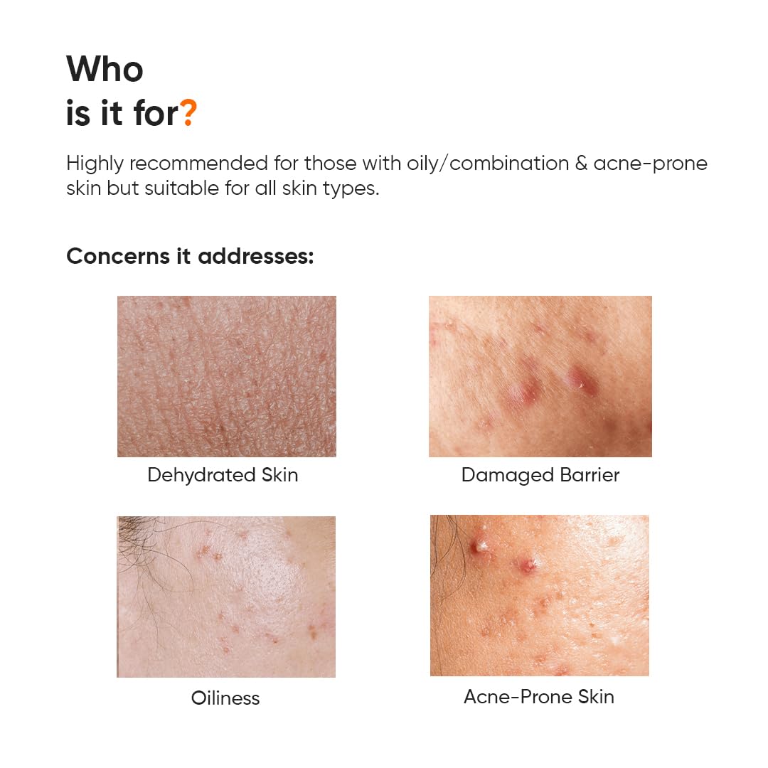 Minimalist Dehydrated Skin Moisturizer with 10% Vitamin B5 for Oily & Acne-Prone Skin, 100 gm