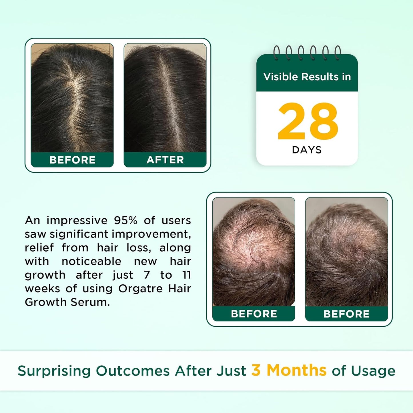 Orgatre Hair Growth Serum for scalp - 50ml | 3% Redensyl, 4% Anagain, 3% Procapil, 1% Capilia Longa & Rosemary Oil