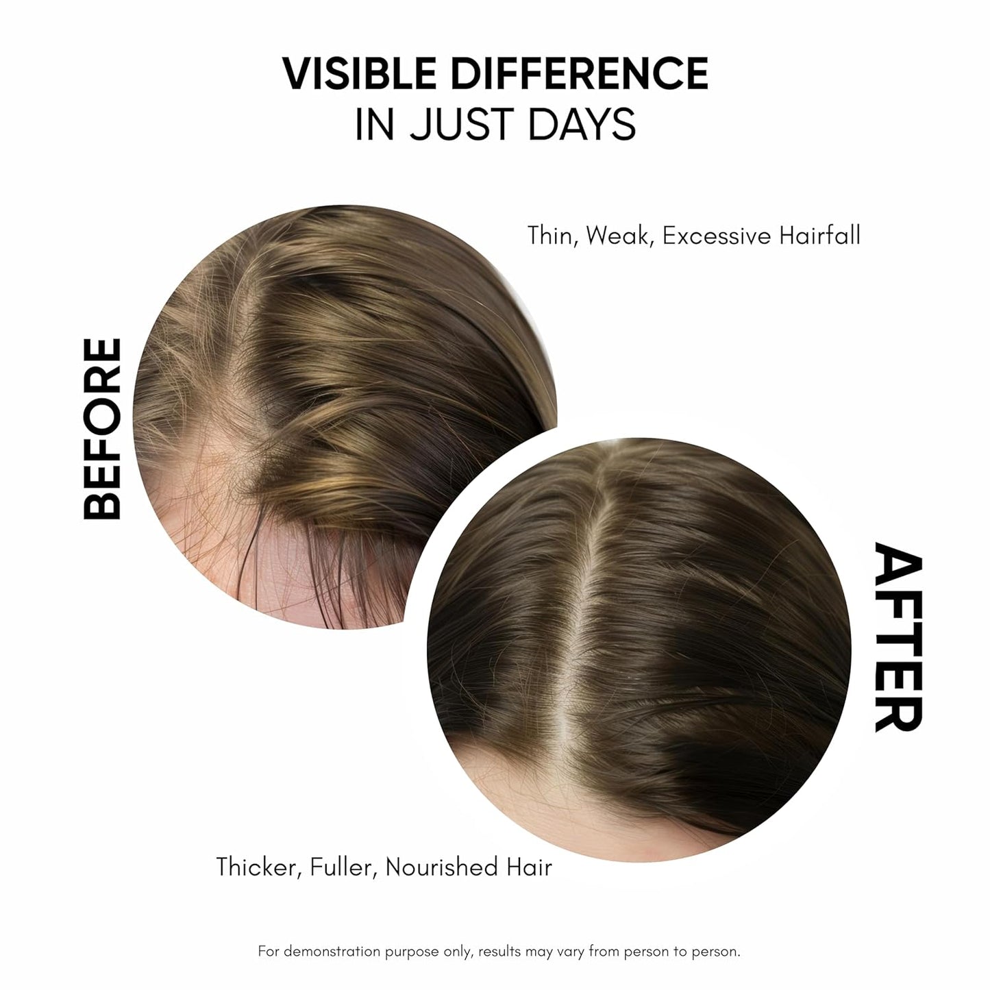 Masofta Hair Growth Serum, 50 ml