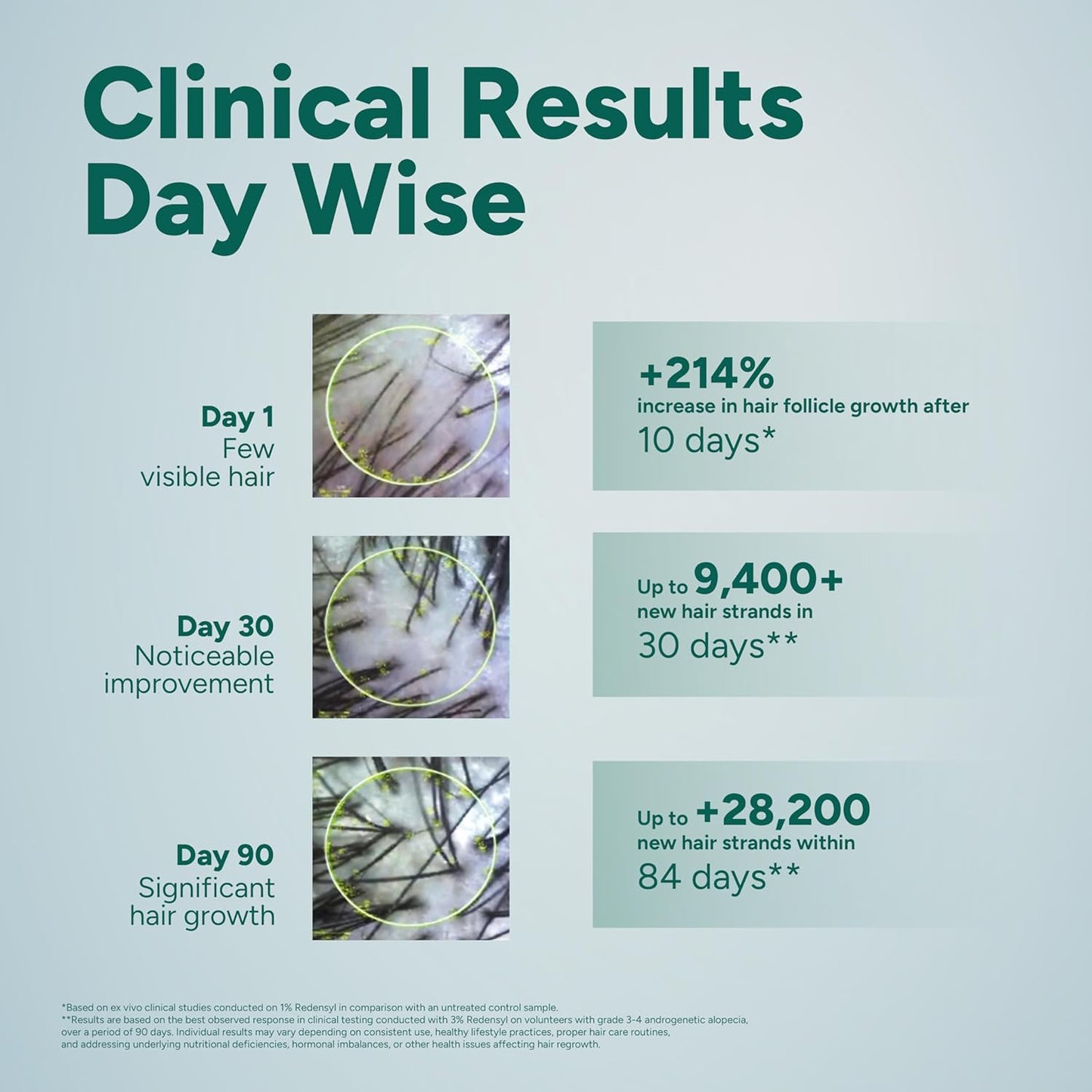 Arata Hair Growth Serum (30ml) with 3% Redensyl, 3% Procapil, 5% Kopexil, Caffeine & Rice Water | No Minoxidil | Supports Hair Growth | Helps Reduce Hairfall | Serum For Women and Men