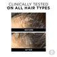 Loreal Paris Anti-Hair Fall Shampoo, Reinforcing & Nourishing, Arginine Essence and Salicylic Acid, Fall Resist 3X, 340 ml