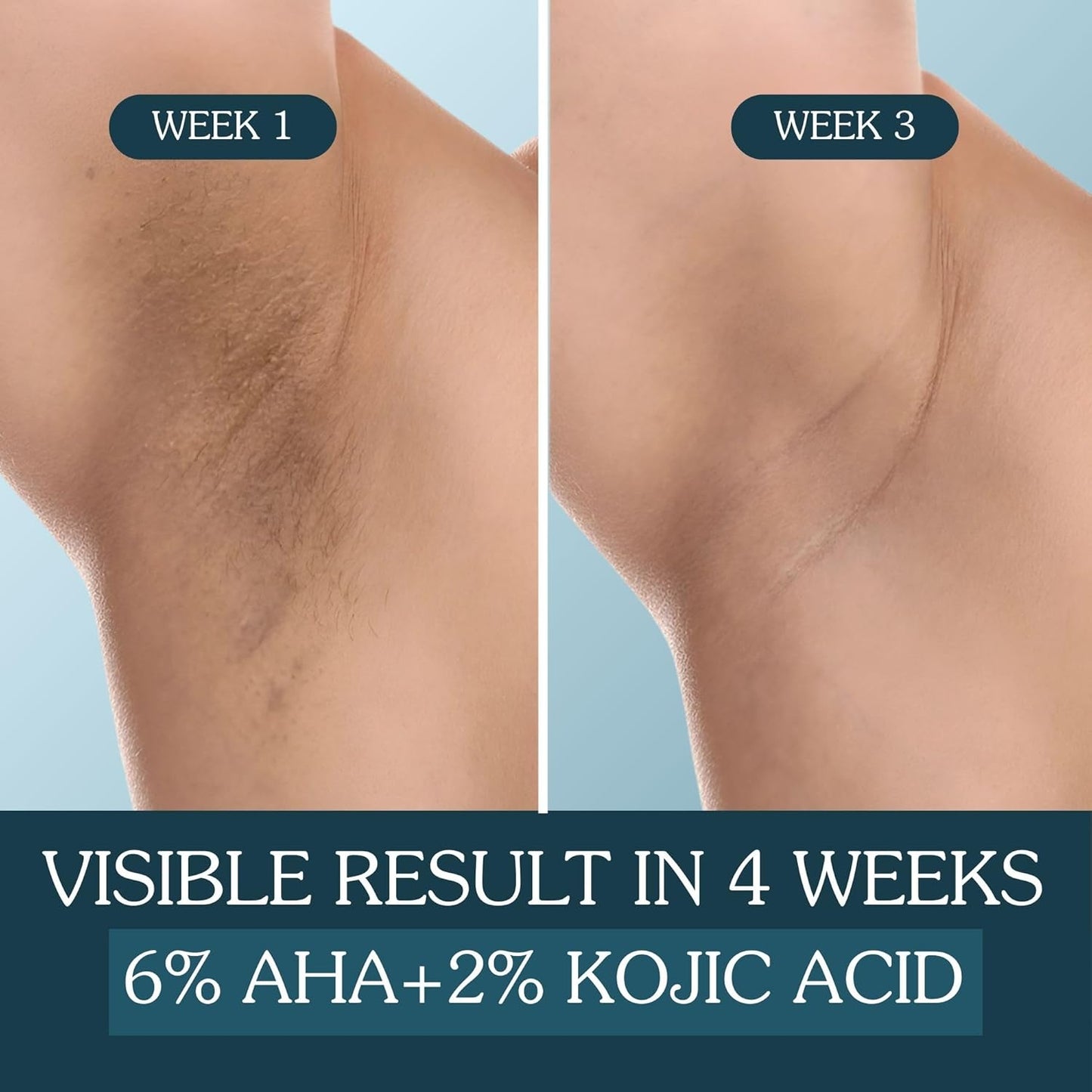 Bake 6% AHA Underarm Roll On with 2% Kojic Acid, 3% Niacinamide, 50 ml