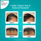 Pilgrim 3% Redensyl & 4% Anagain Advanced Hair Growth Serum, For Dandruff-Prone Scalp, 30 ml