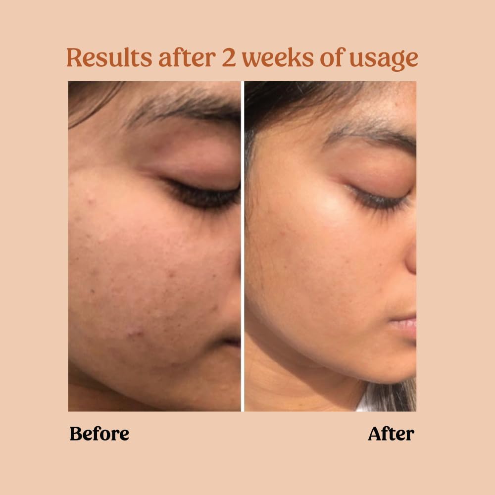 Vilvah Store Milk Powder Face Wash | Gentle Exfoliation & Deep Cleansing | Enriched with Rice Milk, Rice Silk,Rice Powder | For Normal to Oily & Acne Prone Skin | Unscented | Men & Women | 50G