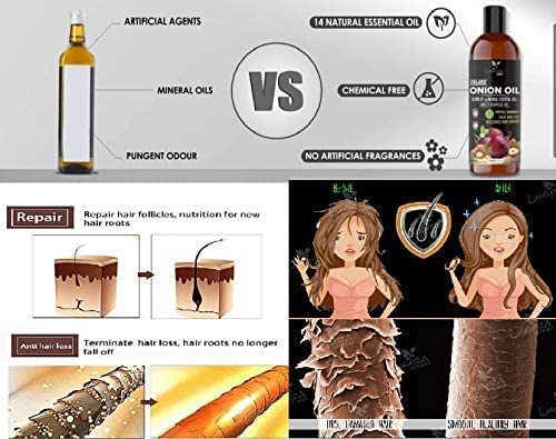 Luxura Sciences Onion Hair Oil with 14 Essential Oils, 250 ml Pack of 2