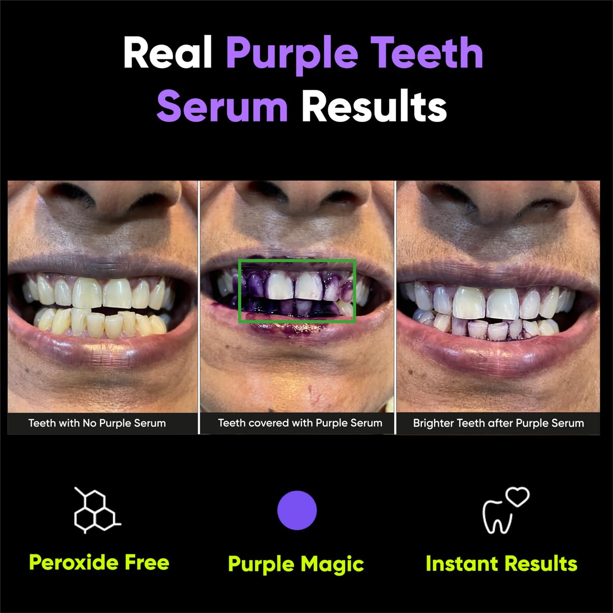 Masofta Purple Teeth Whitening Serum For Yellow & Dark Teeth Stains, 50 ml