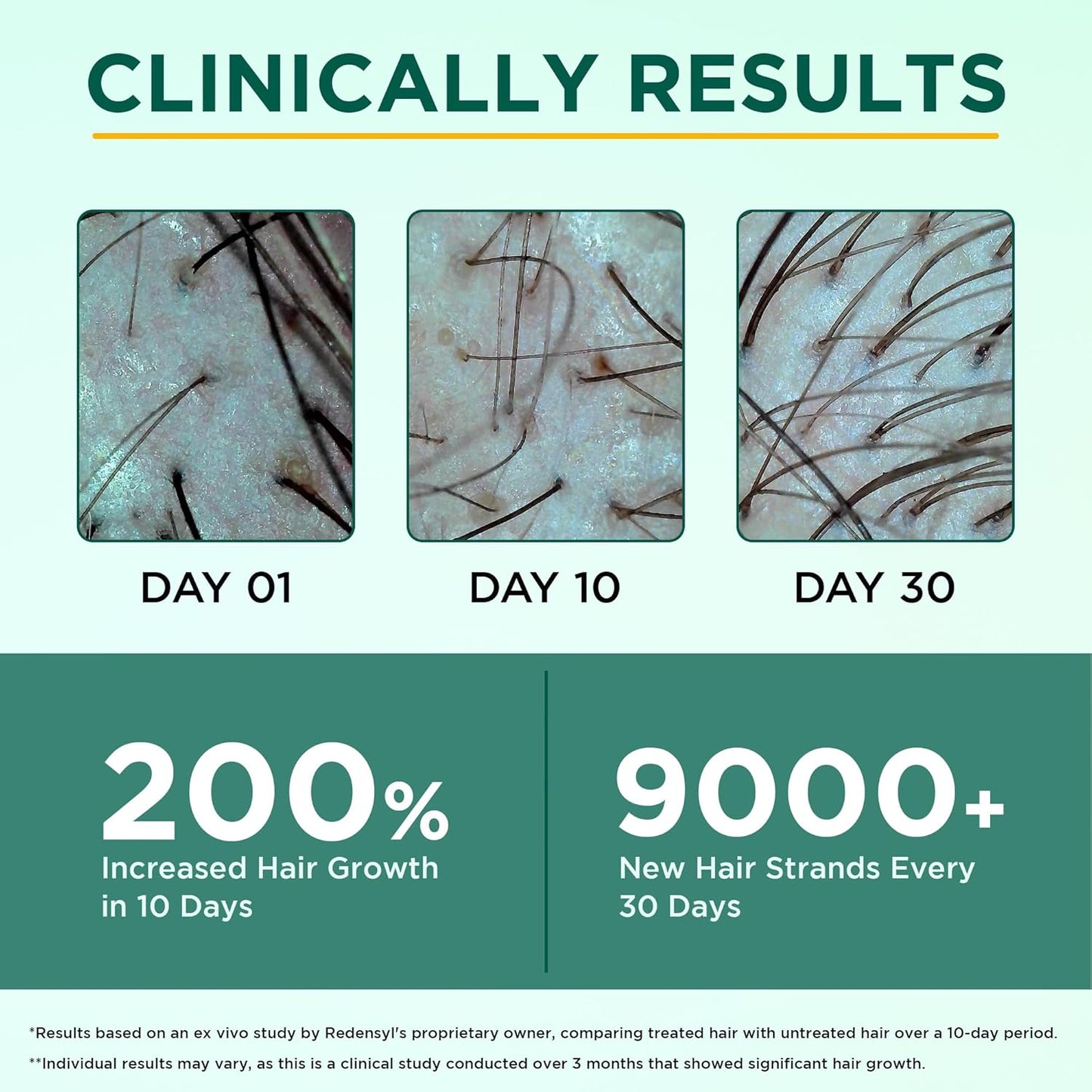 Orgatre Hair Growth Serum for scalp - 50ml | 3% Redensyl, 4% Anagain, 3% Procapil, 1% Capilia Longa & Rosemary Oil