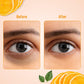 Swiss Beauty Hydra Anti Wrinkle Eye Serum Patch| Treats Dark Circles, Fine Lines And Wrinkles | Enriched With Collagen And Aloe Vera Extract | Shade -Gold, 60 Pcs