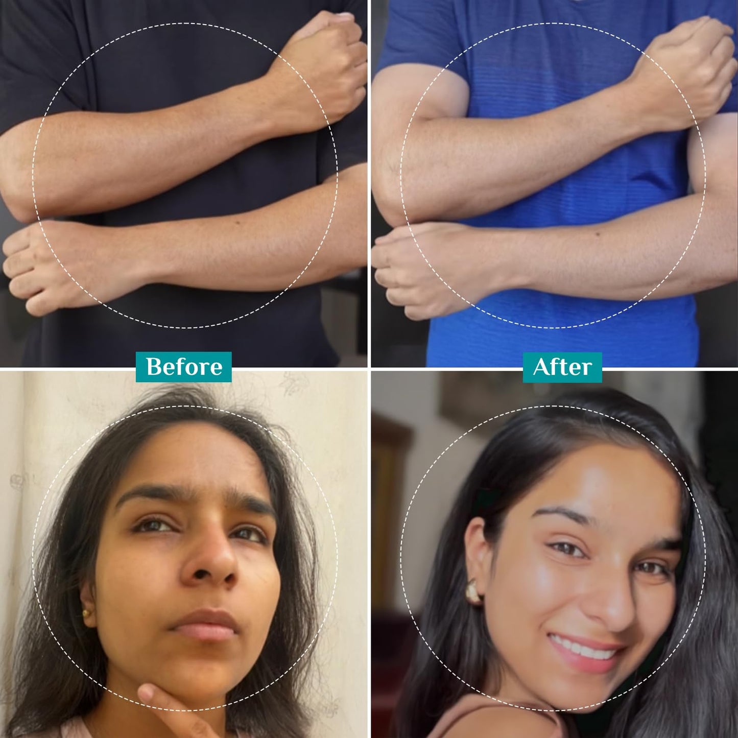 Pilgrim 25% AHA + 2% BHA + 5% PHA Peeling Solution 30ml For Face & Body |10-Minute Facial At Home