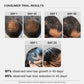 Bare Anatomy Advanced Hair Growth Serum | 3% Redensyl + 4% Anagain + 3% Baicapil + 1% Capilia Longa, Rosemary, Biotin & Rice Extract | Hair growth & Hair fall control serum for Women & Men | 30mL (Pack of 3)
