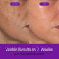 Bake 1% Kojic Acid Night Peel Off Mask with Niacinamide & Turmeric, 100 gm