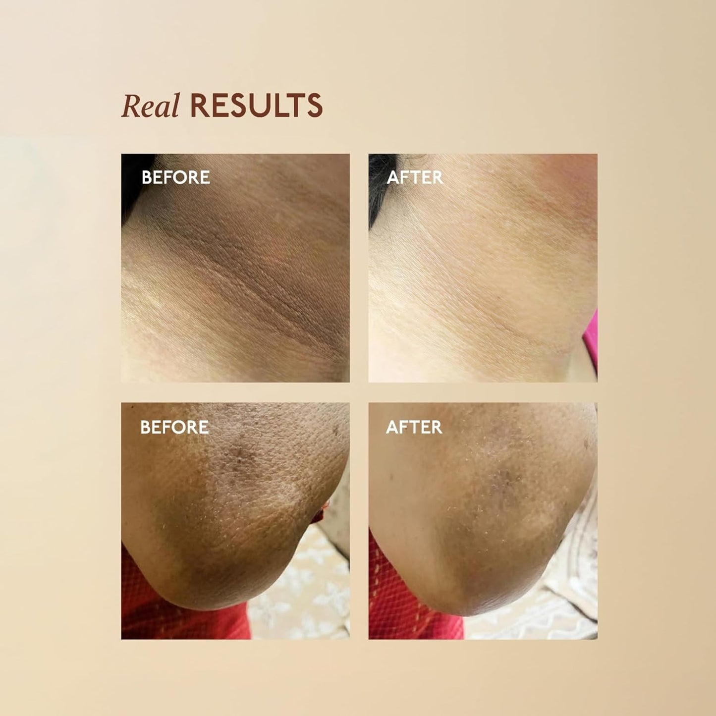 Asaya | Tone Restore | Advanced Pigmentation Cream 50 g